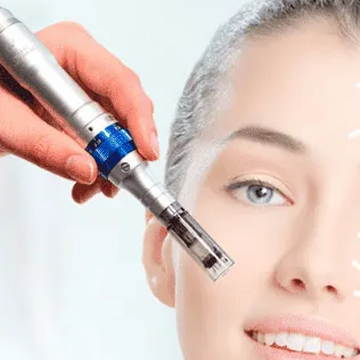 Tratamento usando a crioterapia em albufeira