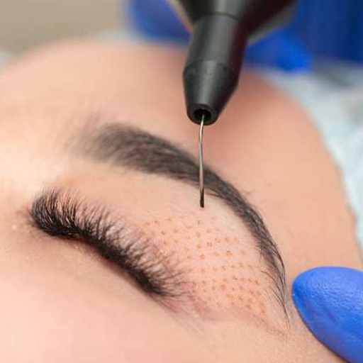 Jato de Plasma ou Blefaroplastia - É um tratamento estética destinada a melhorar a pele enrugada e descaída das pálpebras superiores e/ou inferiores